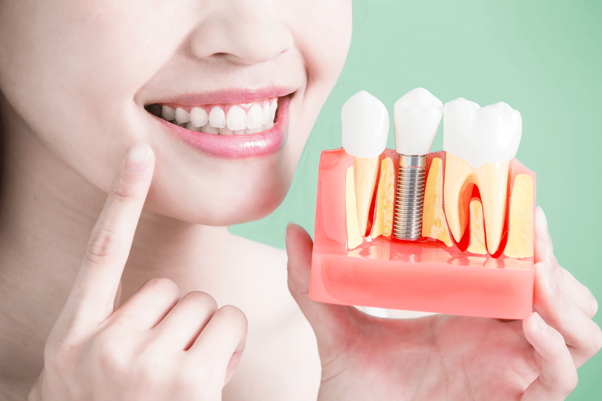 dental implants Replace Your Missing Teeth With Dental Implants Lake of the pines dental dentist in Auburn California